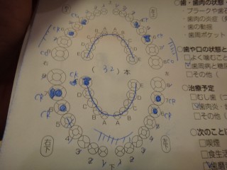 健康チェックの日（歯編）